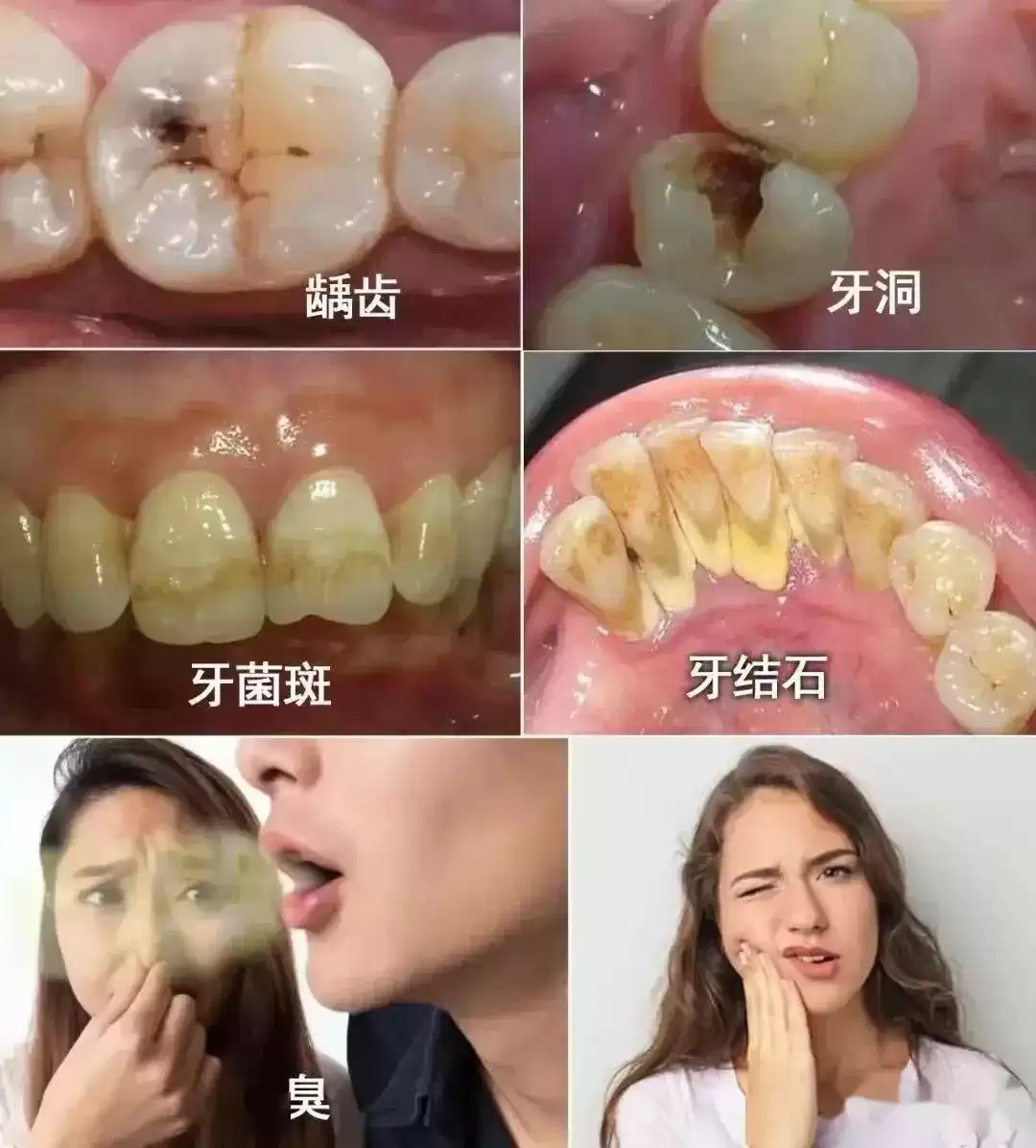 科技守护笑容革命：国家大奖助力牙齿重获新生！