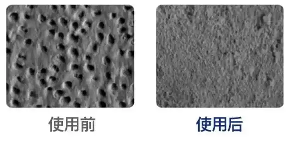 科技守护笑容革命：国家大奖助力牙齿重获新生！