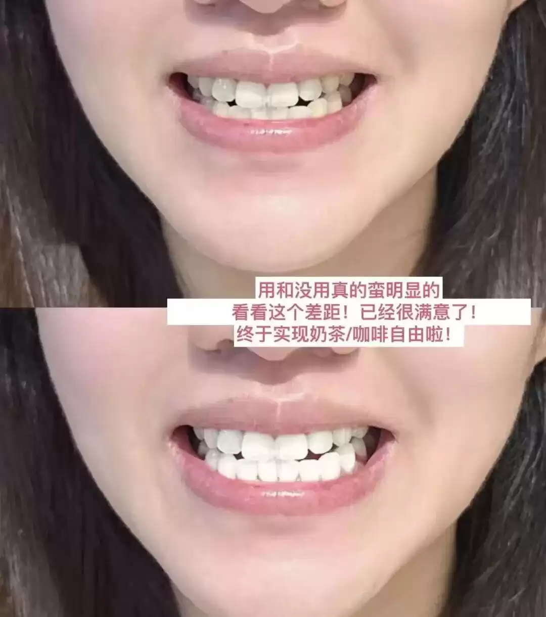 科技守护笑容革命：国家大奖助力牙齿重获新生！