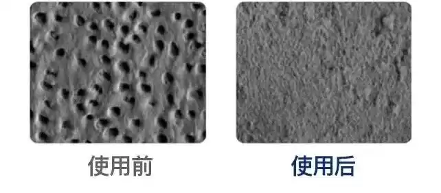 科技守护笑容革命：国家大奖助力牙齿重获新生！