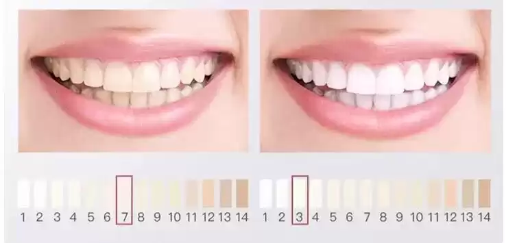 科技守护笑容革命：国家大奖助力牙齿重获新生！