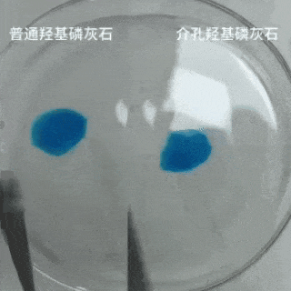 科技守护笑容革命：国家大奖助力牙齿重获新生！