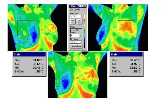 医学成像技术大揭秘：X光、CT、MRI、热成像仪，如何成为医生的“透视眼”？-第2张图片-正海烽科技 - 领先的只能推广行业，智能制造解决方案提供商