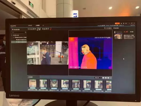 医学成像技术大揭秘：X光、CT、MRI、热成像仪，如何成为医生的“透视眼”？-第3张图片-正海烽科技 - 领先的只能推广行业，智能制造解决方案提供商