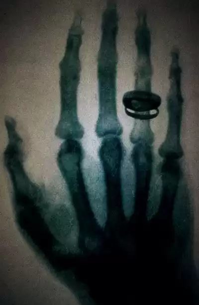 医疗成像技术大起底：X光、CT、MRI、热成像仪，你了解多少？