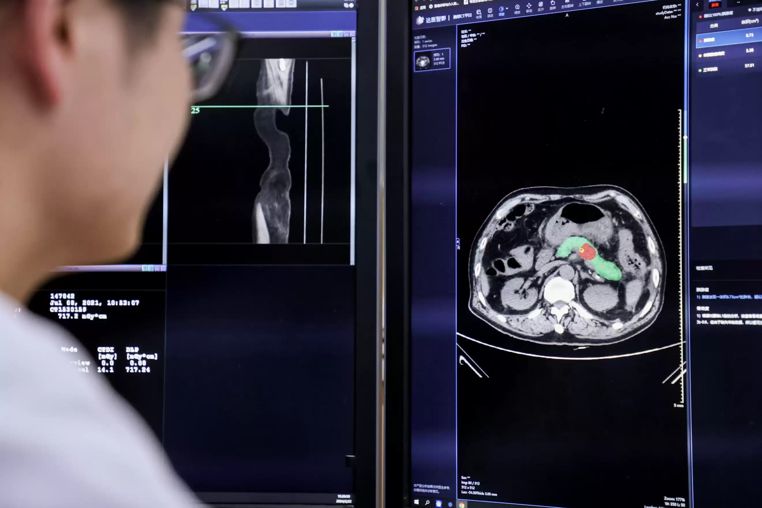 阿里巴巴首发AI向善行动报告：技术成熟的终极试炼，定义伦理新高度-第4张图片-正海烽科技 - 领先的只能推广行业，智能制造解决方案提供商