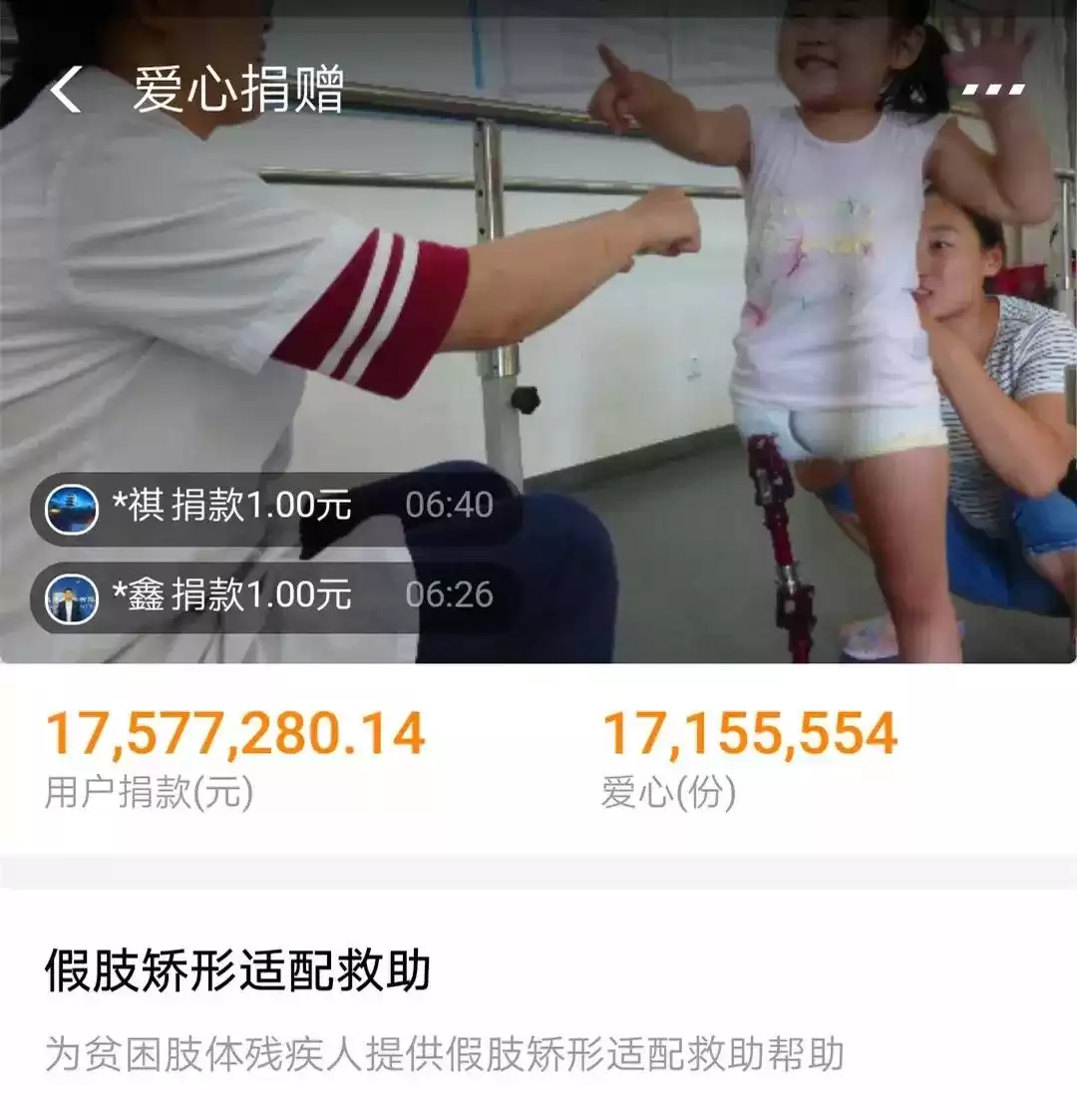 从零到一：假肢制造的科技奇迹与推广挑战