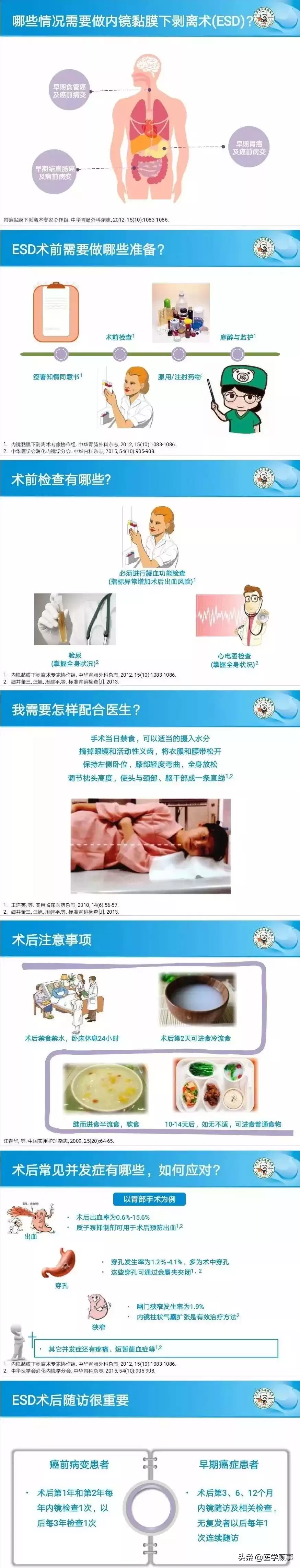 内镜黏膜下剥离术（ESD）：微创革命，根除早癌，保住器官！