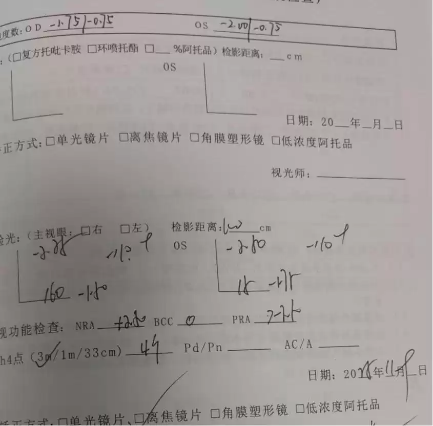 惊爆！少年近视一年暴涨125度，三年后仅增75度，这项黑科技成功刹车！