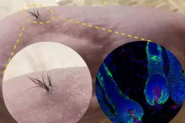 革命性突破！克隆毛囊：彻底终结“聪明绝顶”，发量自由触手可及