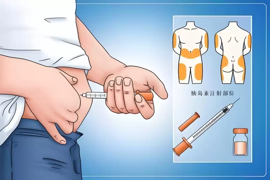 医疗霸权易主？美国神话破灭，中国糖尿病治愈突破震惊世界！