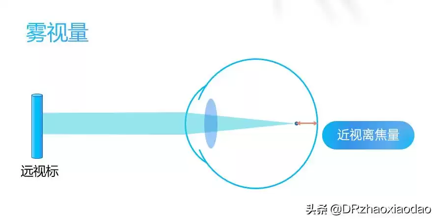 雾视屏&雾视镜终极：逆转近视黑科技，一篇看懂所有！