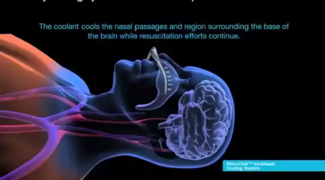 突破维度！三体冬眠技术：道法自然，铸就星际航行新纪元