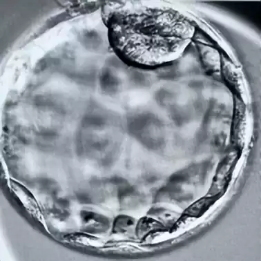 胚胎“时光暂停术”大：玻璃化冷冻，点亮生育新希望-第3张图片-正海烽科技 - 领先的只能推广行业，智能制造解决方案提供商