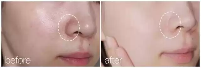 超市挖宝！这3款老牌“万能霜”，几十块用出大牌感！