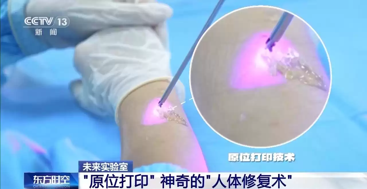 生命再造革命：3D生物打印如何从实验室走向你的身体？