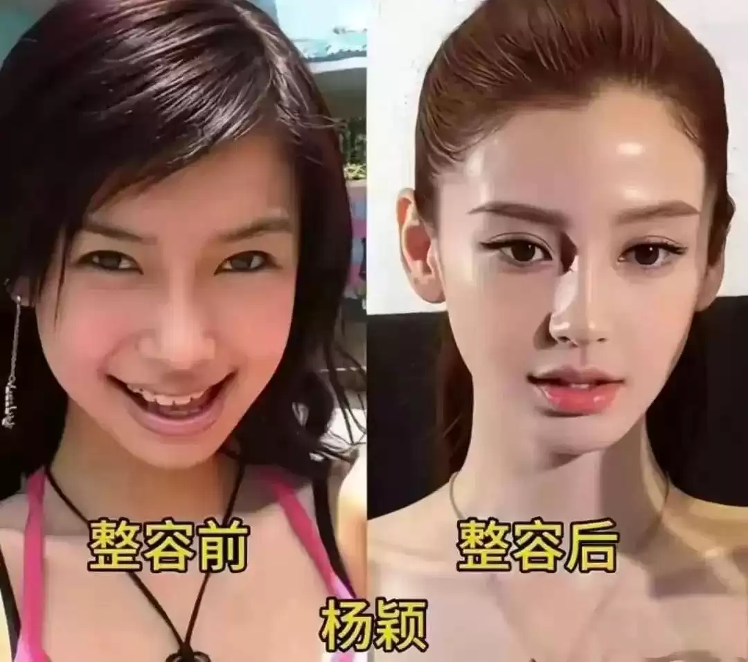 颜值革命：女星整容进化论，谁在定义美的游戏规则？