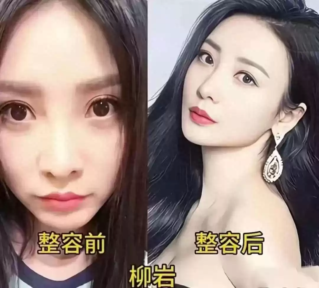颜值革命：女星整容进化论，谁在定义美的游戏规则？