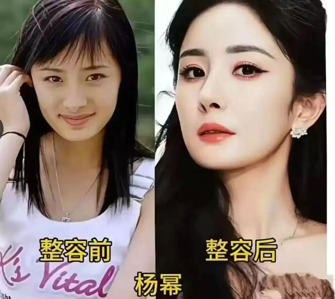 颜值革命：女星整容进化论，谁在定义美的游戏规则？