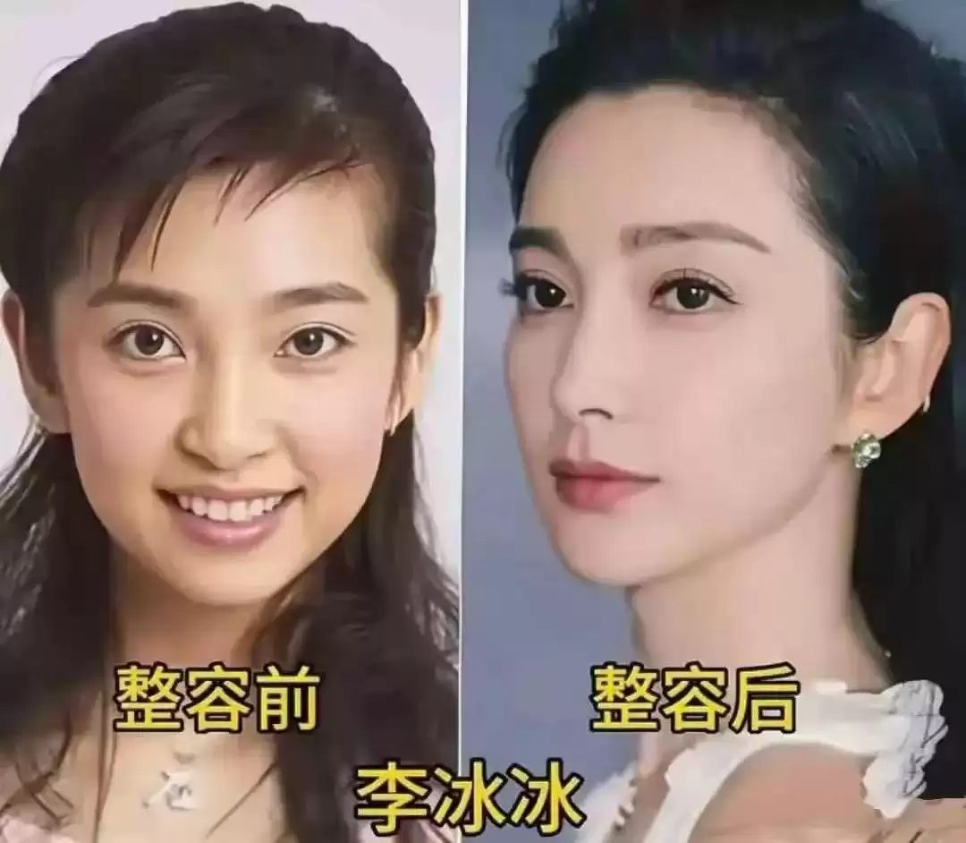颜值革命：女星整容进化论，谁在定义美的游戏规则？