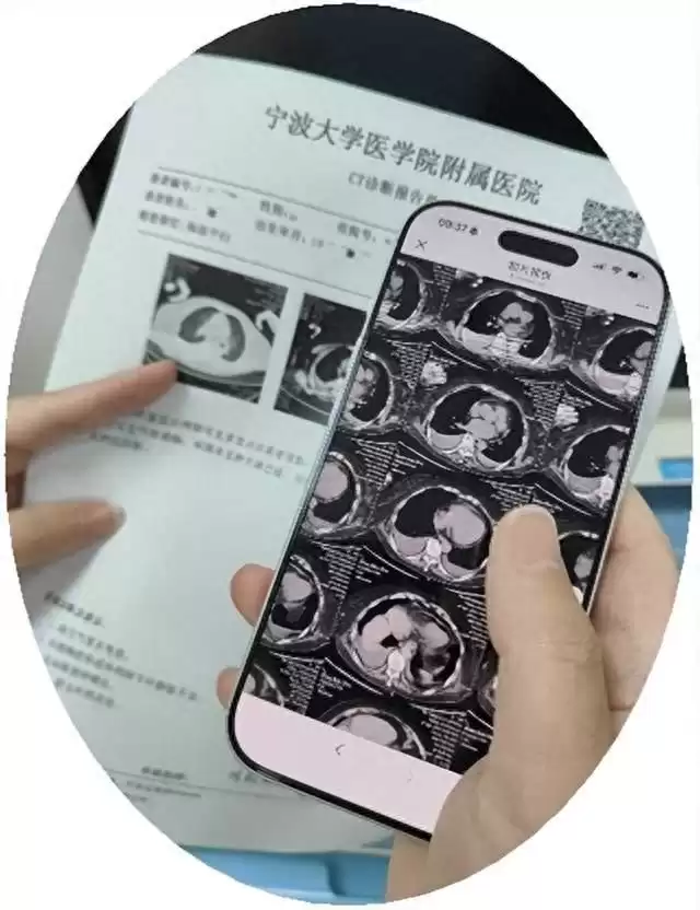 重磅！24省医保影像云全面落地，胶片数字化掀起智慧医疗新浪潮