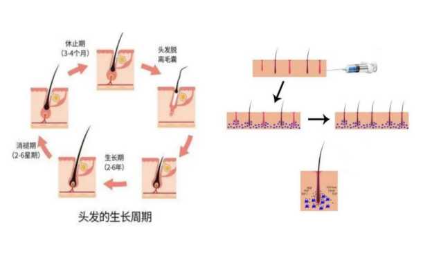 斑秃治疗新技术全知道