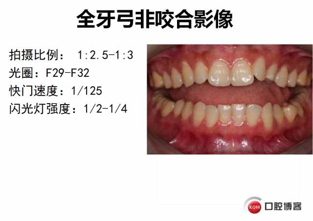 智能口腔拍照技术，让牙科护理更贴心