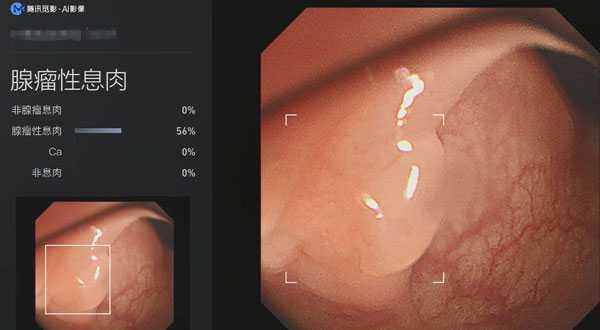 智能硅胶直肠整理新篇章：舒适护理的革命