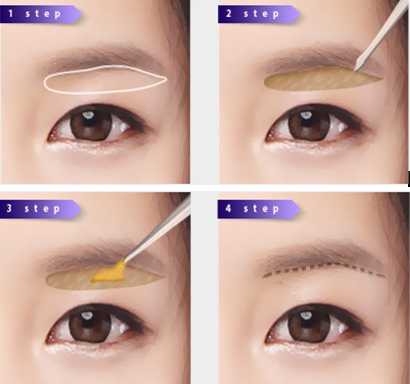 武汉种眉毛TDDP技术到底有几扎实-第2张图片-正海烽科技 - 领先的只能推广行业，智能制造解决方案提供商