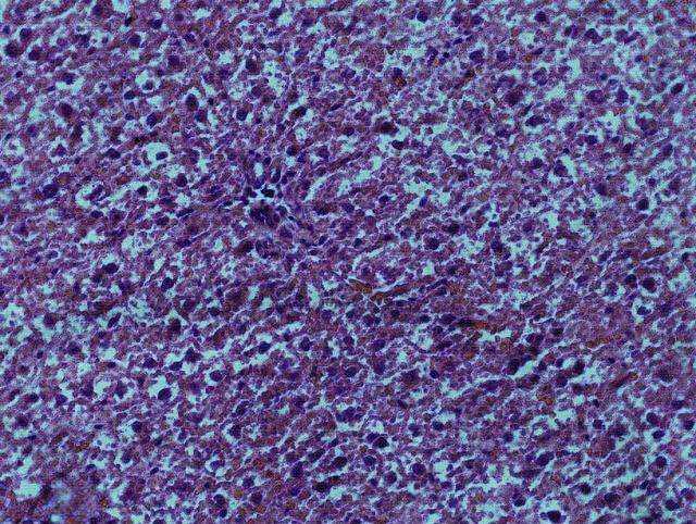 猪血与石灰的千年之约：传统血灰制作技艺的智慧与传承