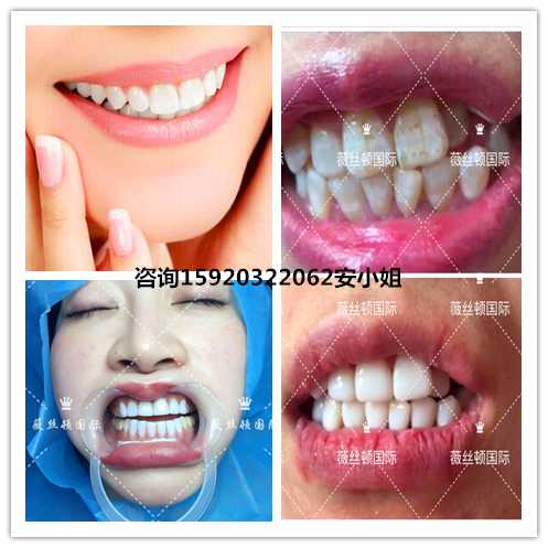 让牙冠“长”得跟真牙一样：从手工雕琢到智能设计的奇妙之旅