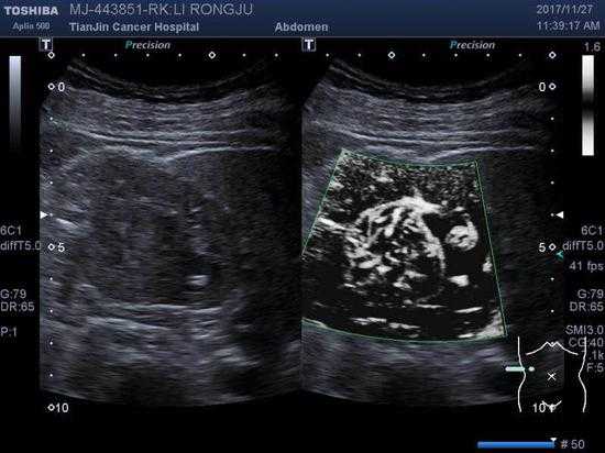 肿瘤成像技术：照亮健康之路的明灯-第2张图片-正海烽科技 - 领先的只能推广行业，智能制造解决方案提供商