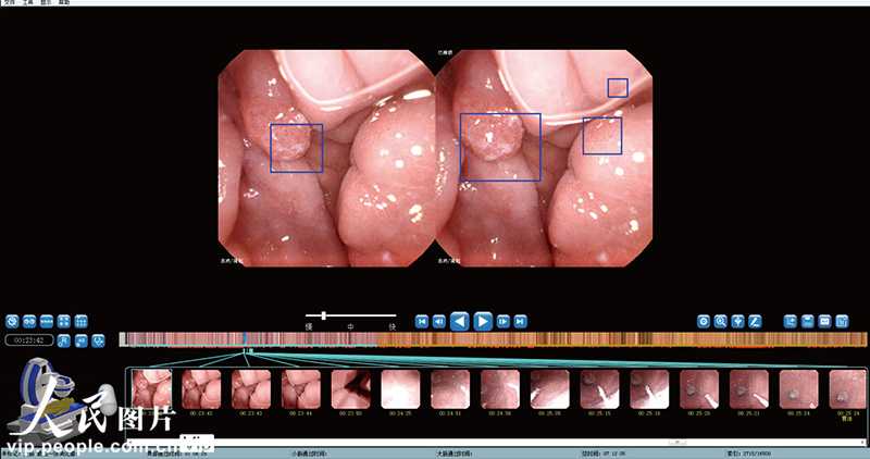 胃里乾坤AI知晓：那根让人望而生畏的管子，正在被时代温柔改变