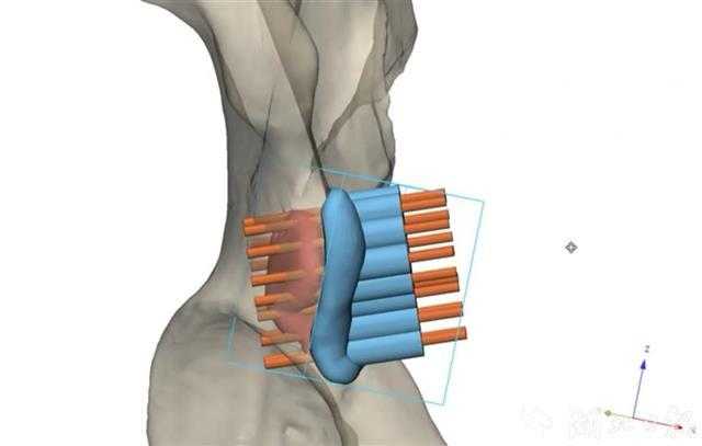 脚崴了别硬扛,三维智能黑科技让你告别反复扭伤的老毛病 脚崴了别硬扛,三维智能黑科技让你告别反复扭伤的老毛病