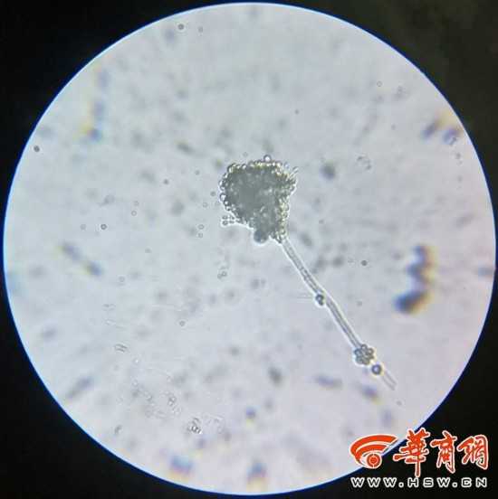 藏在皮肤深处的“长技术霉菌”，你了解多少？