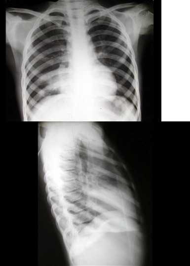长骨大关节不再“拍不全”：X线拼接技术的前世今生