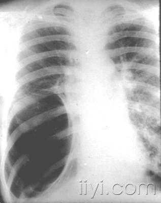 长骨大关节不再“拍不全”：X线拼接技术的前世今生