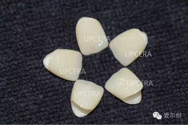 陶瓷染色技术新突破：让千年窑火绽放更安全绚丽的色彩