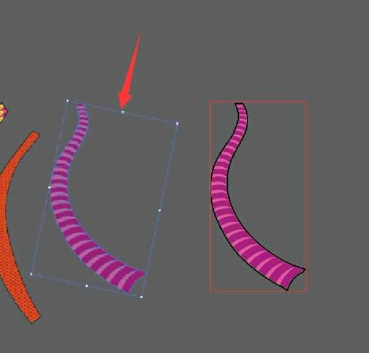AI成为中风克星：从预警到康复的智能守护神