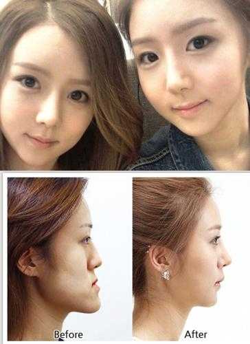 中国整容，不再是你想的那样了：从“换脸”奇迹到日常护肤的温柔革命-第1张图片-正海烽科技 - 领先的只能推广行业，智能制造解决方案提供商