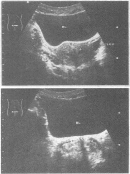 产科远程超声技术：孕期检查的智慧新选择