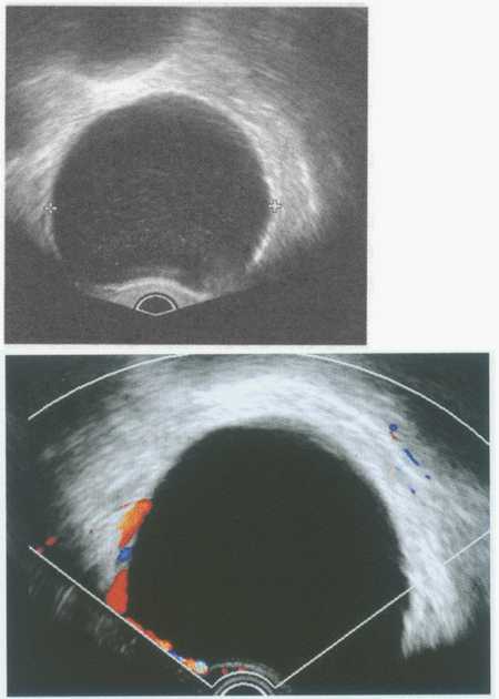 产科远程超声技术：孕期检查的智慧新选择