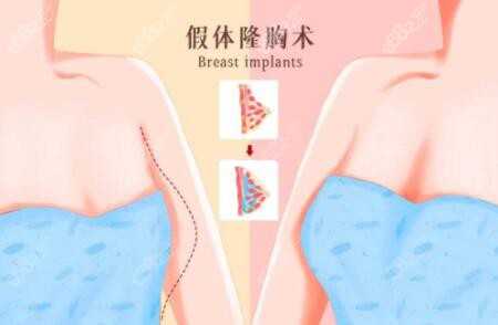 你那胸口的事儿，是咋个不舒服法儿？