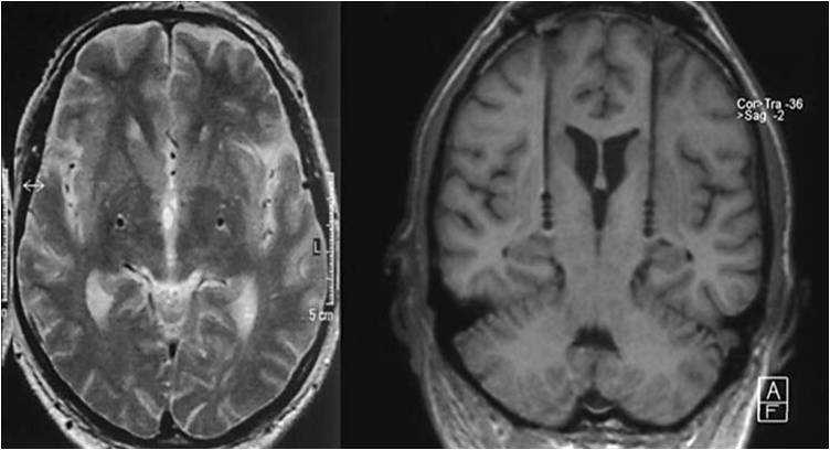 动磁经络技术真能治病?深入解析其原理与临床效果-第2张图片-正海烽科技 - 领先的只能推广行业,智能制造解决方案提供商 动磁经络技术真能治病?深入解析其原理与临床效果-第2张图片-正海烽科技 - 领先的只能推广行业,智能制造解决方案提供商