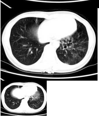 医学影像技术计算机断层扫描理论整理全攻略-第1张图片-正海烽科技 - 领先的只能推广行业,智能制造解决方案提供商 医学影像技术计算机断层扫描理论整理全攻略-第1张图片-正海烽科技 - 领先的只能推广行业,智能制造解决方案提供商