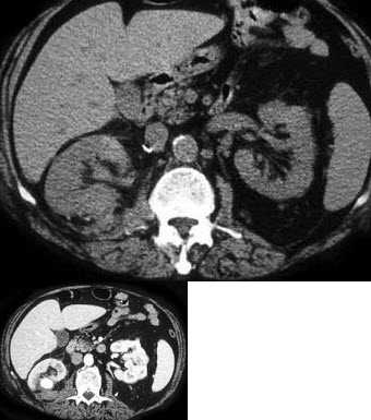 医学影像技术计算机断层扫描理论整理全攻略-第2张图片-正海烽科技 - 领先的只能推广行业,智能制造解决方案提供商 医学影像技术计算机断层扫描理论整理全攻略-第2张图片-正海烽科技 - 领先的只能推广行业,智能制造解决方案提供商